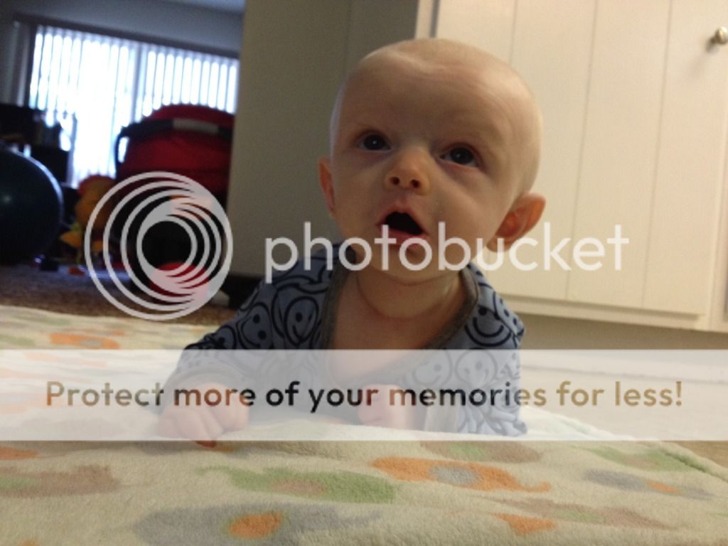 added more pics Worried about my son�s headshape&hellip; am I